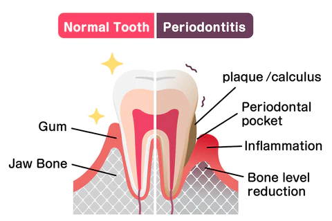 All Nature Oral Gum Therapy Treatment Gel - Image 6