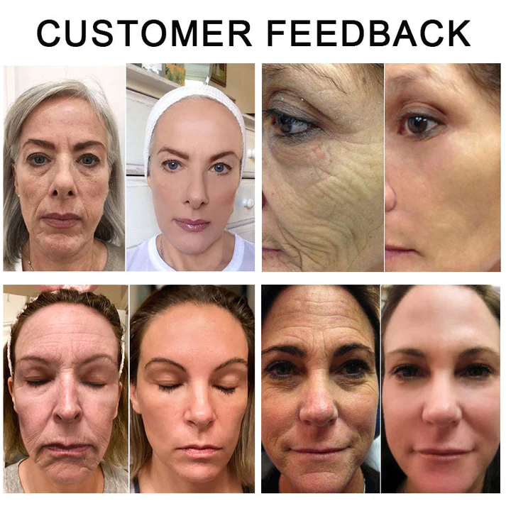 Awzlove™ NMN Age Reversal Hydration Serum - Image 8