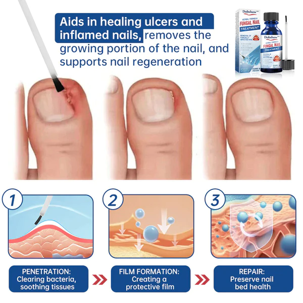 Dobshow™ Herbal Formula Fungal nail Paronychia treatment Gel - Image 7