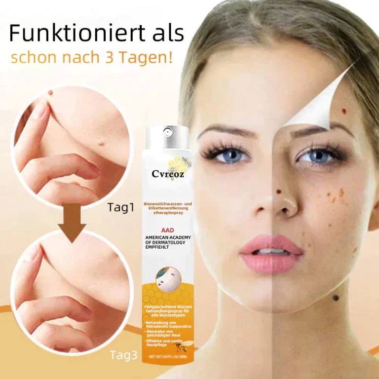 Ourlyard™ Biene Venom Wart und Tags Entfernung Behandlung Spray - Image 4