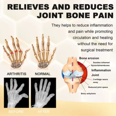 Lotmay™ Bee Venom Pain and Bone Healing Spray - Image 6