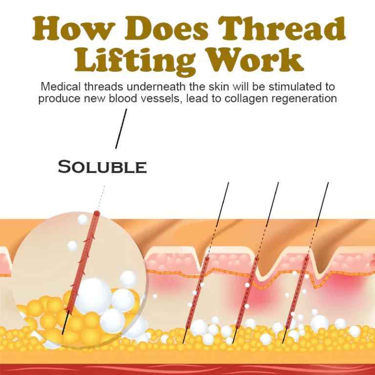 ATTDX Divine Lifting Protein Threads - Image 5