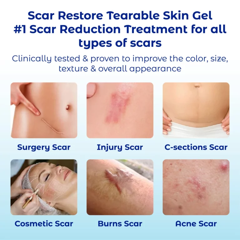 ATTDX ScarRestore Tearable Skin Gel - Image 7