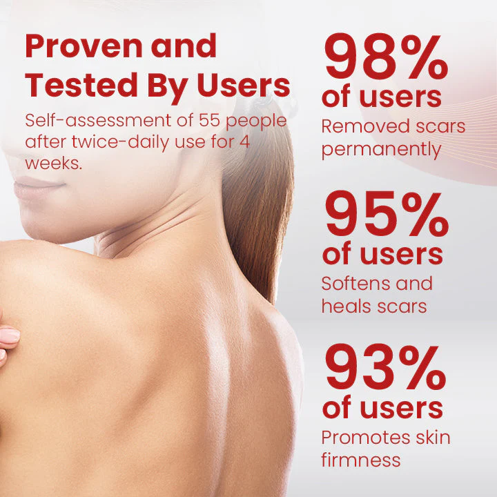 Ceoerty™ SkinClear Tags & Mole Remover - Image 3