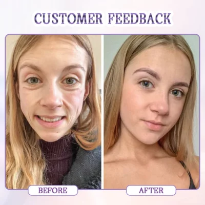 Biancat™ Age-Defying Botulinum Facial Serum - Image 6