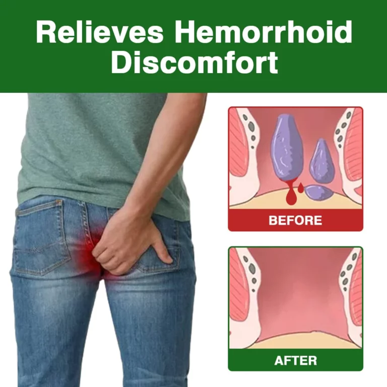 Kisshi™ Hemorrhoid Spray - Image 6