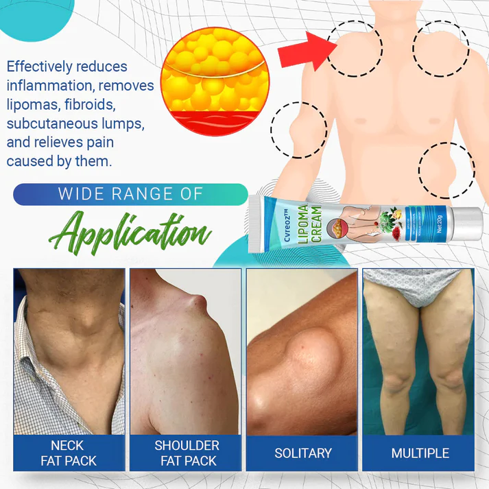 Cvreoz™Lipoma Removal Cream - Image 10