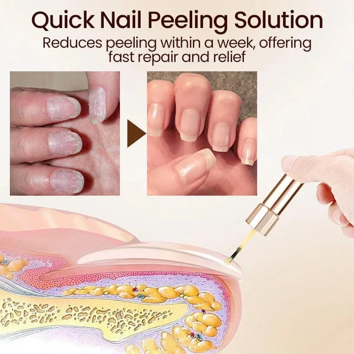 Ceoerty™ Vitamin E Nail Repair Serum - Image 3