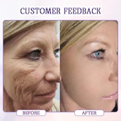 Biancat™ Age-Defying Botulinum Facial Serum - Image 5