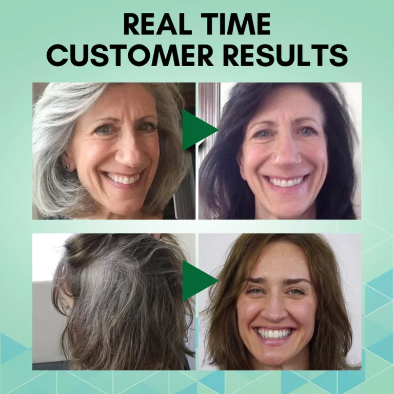 RootRevive™ Hair-Reviving Foam Shampoo - Image 5