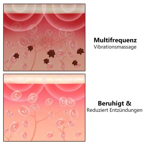 iRosesilk™ RespiRevive EMS Nasaltherapie-Instrument - Image 10