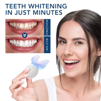 Oveallgo™ ProTeeth Whitening Kit - Image 4