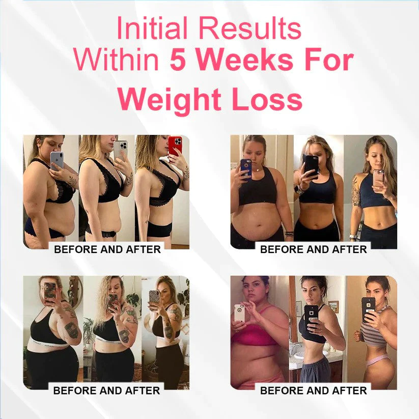 EXPECTSKY™ Negative Oxygen Ion Fat Burning Tummy Control & Detox Bodysuit - Image 7