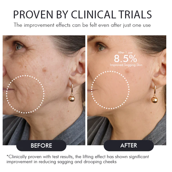 Oveallgo™ Korean Gold Seal Lifting Cream+ 2-in-1 Red Light / EMS Therapy Device SET - Image 8