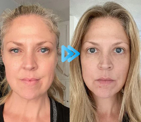 Bostore™ Myopia Reversal Eye Drops - Image 10