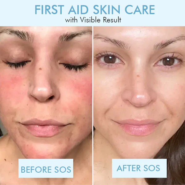 Oveallgo™ Korean Bio-Collagen Real Deep Mask - Image 10