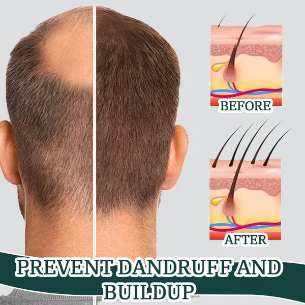 Biancat™ CentellaGrowth Scalp Scrub - Image 4