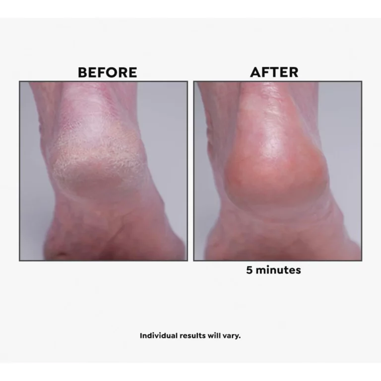 Imperial Honey Deluxe 2-piece Kit - Image 4