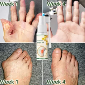 Lotmay™ Bee Venom Pain and Bone Healing Spray - Image 5
