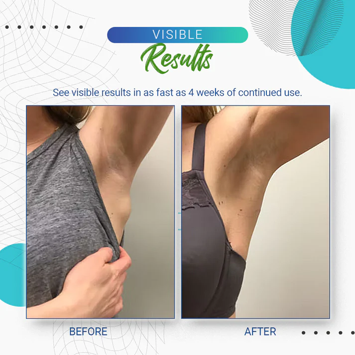 Cvreoz™Lipoma Removal Cream - Image 12