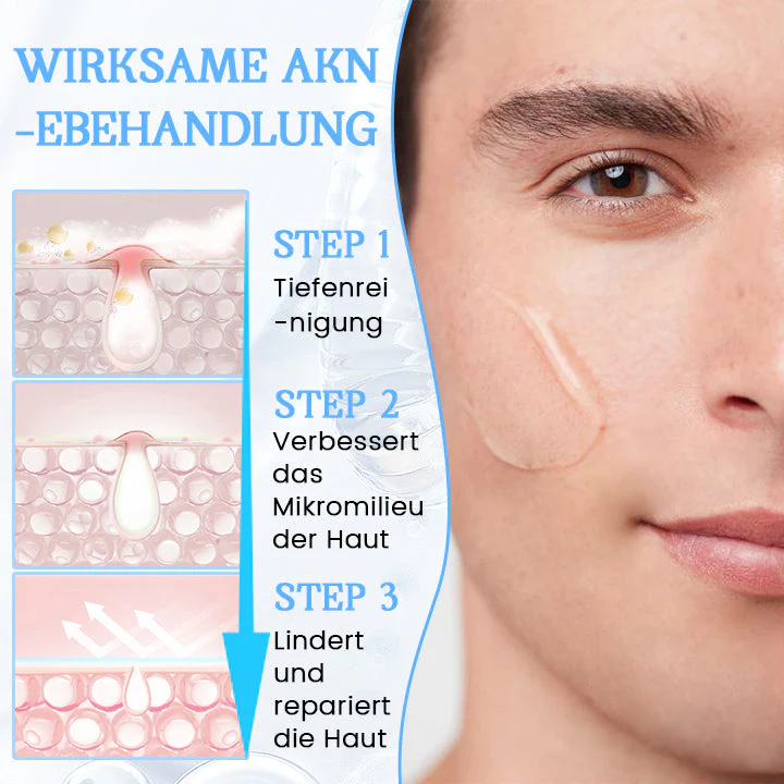 Biancat™ PoreClear 2% BHA Hauterneuerungsflüssigkeit - Image 4