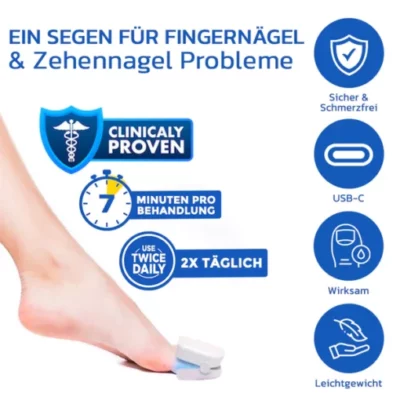GFOUK™ FungusOFF Nagellaser-Behandlungsgerät - Image 5