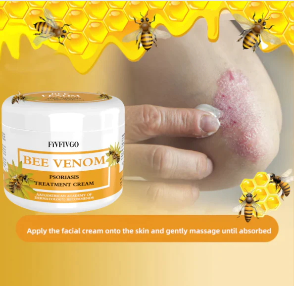 Fivfivgo™ BeeVenom Psoriasis-Lösungs-Creme - Image 3
