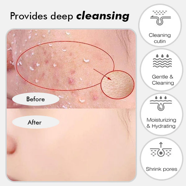 Fivfivgo™ Aufhellendes Haut-Peeling-Gel auf Kräuterbasis - Image 9