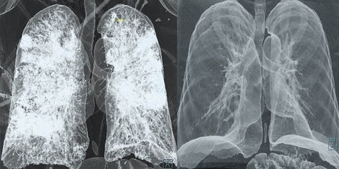 Awzlove™ Natural Herbal Spray - Image 7