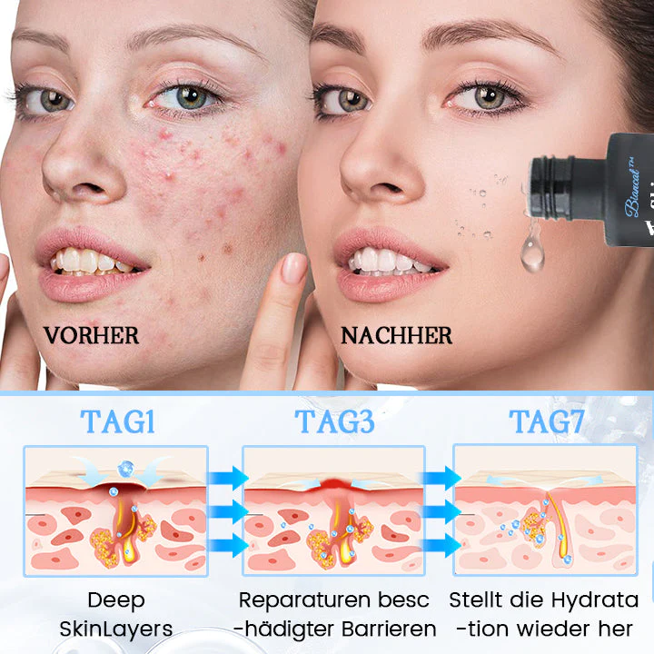 Biancat™ PoreClear 2% BHA Hauterneuerungsflüssigkeit - Image 5