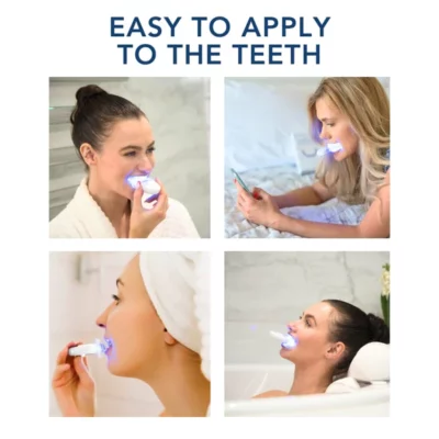 Oveallgo™ ProTeeth Whitening Kit - Image 7