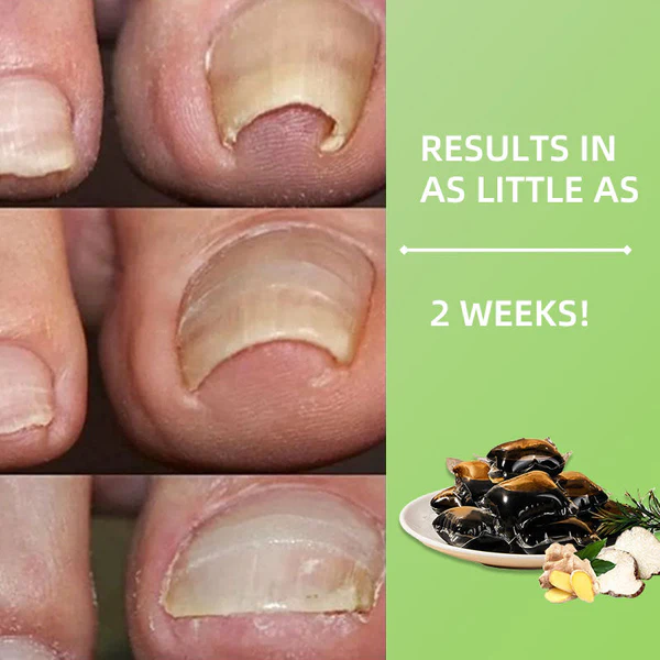 FootHealth™ Foot Bath Therapy Gel Beads - Image 6