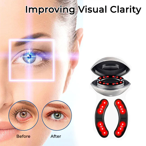 Oveallgo™ VisionPro Microcurrent Heated Ocular Vitality Device - Image 4