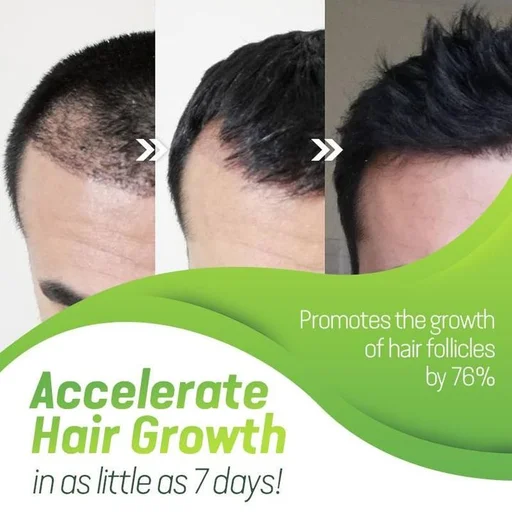 CroAie™ Rapid Hair Growth Serum - Image 6