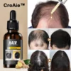CroAie™ Rapid Hair Growth Serum