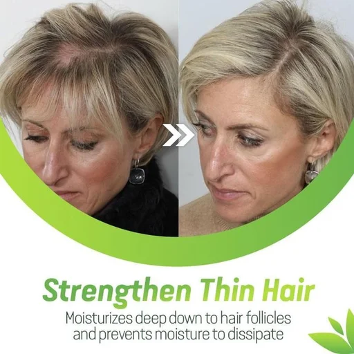 CroAie™ Rapid Hair Growth Serum - Image 3