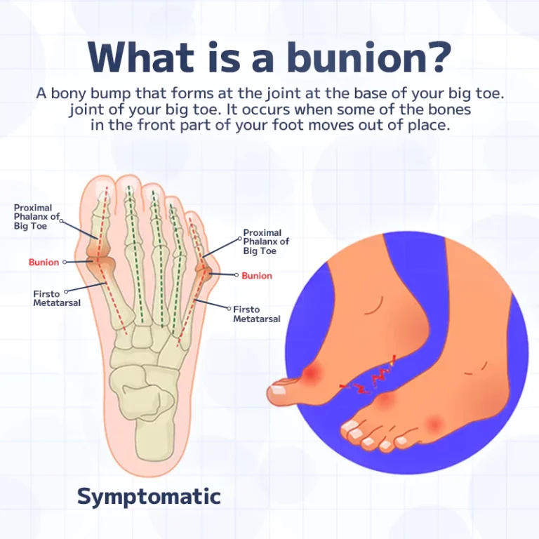 Furzero™ Toe Corrector Composite Patch - Image 6