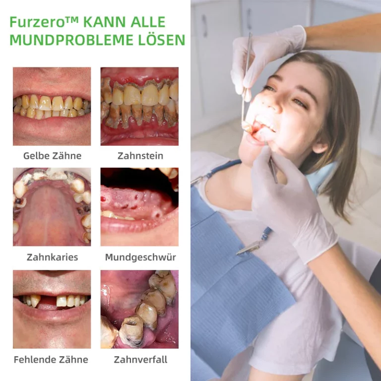 Furzero™ Kräuterhelles Mundreparatur-Schaum - Image 6