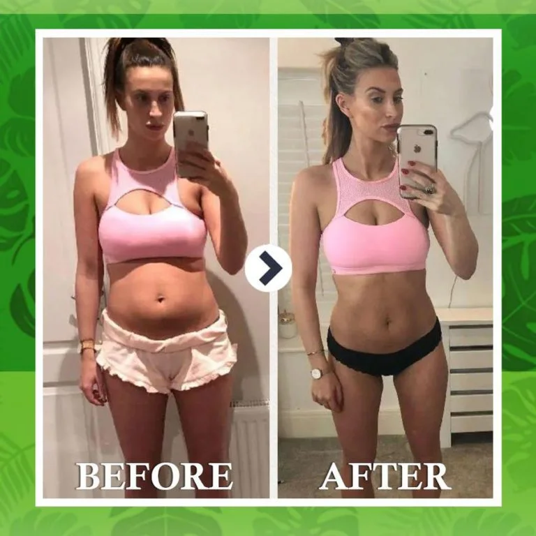 Furzero™ Healthy Fat Reduction Patches - Image 6