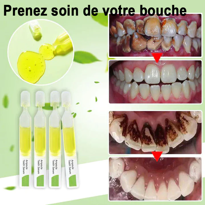 Sérum de blanchiment des dents éliminer les taches et blanchir les dents - Image 4