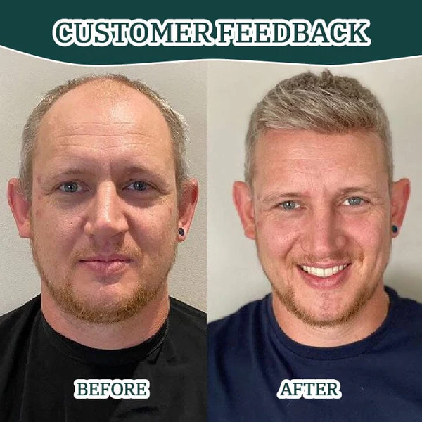 Biancat™ CentellaGrowth Scalp Scrub - Image 6