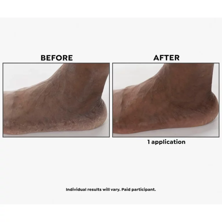 Imperial Honey Deluxe 2-piece Kit - Image 3