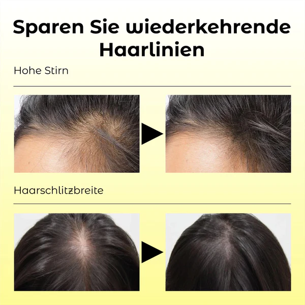 ATTDX Natürliches Haarwachstums Essential Öl - Image 7