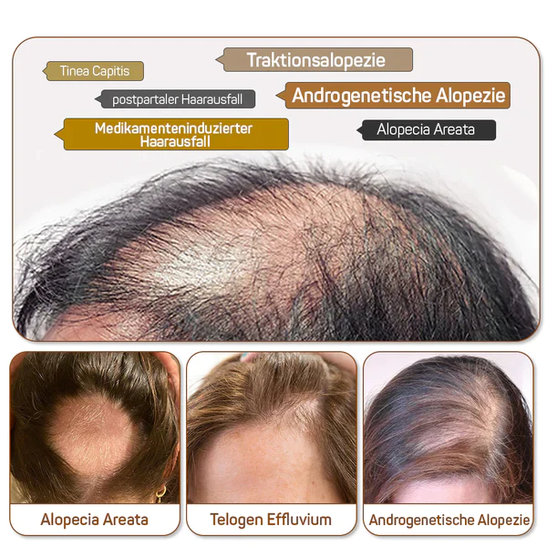 Fivfivgo™ Thermotherapie-Haarwuchs-Kappe - Image 6