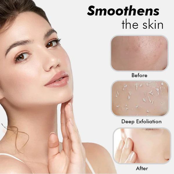 Fivfivgo™ Aufhellendes Haut-Peeling-Gel auf Kräuterbasis - Image 8