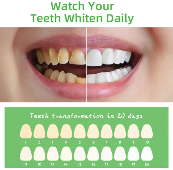 Fivfivgo™ Kräuter Aufhellung Mündlich Reparatur-Mousse - Image 5