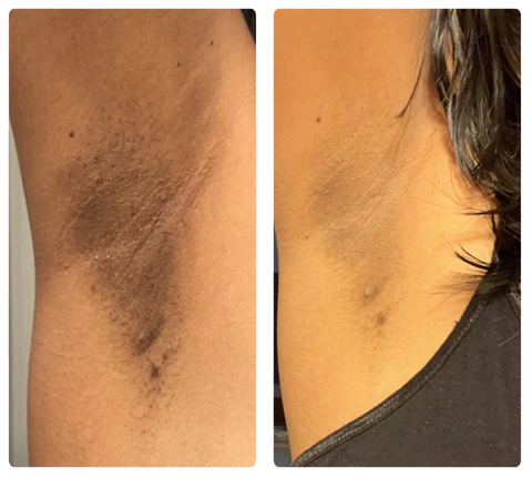 ATTDX Volcanic Mineral Absorbing Roller Stick - Image 7