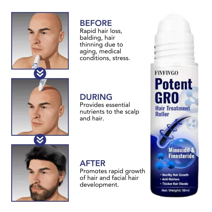 Fivfivgo™ PotentGRO Hair Treatment Roller - Image 5