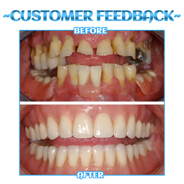 Dobshow™ SmileBright Mousse - Image 4