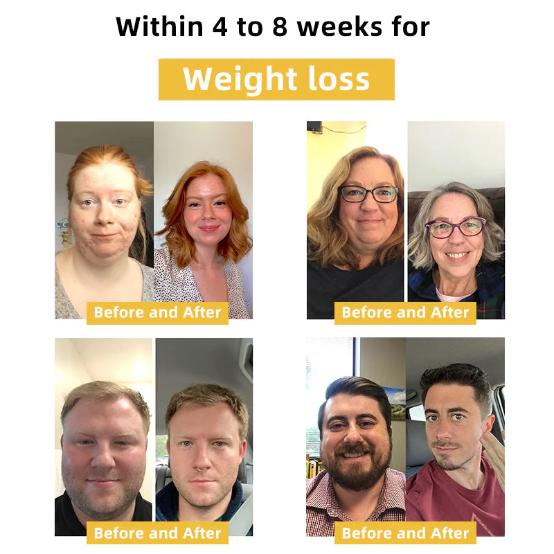 SEAGRIL™ Bee Venom Lymphatic Drainage & Slimming Nose Ring - Image 6